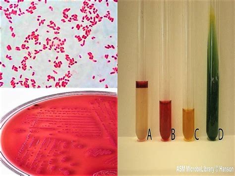 escherichia coli biochemical test|e.coli identification tests.